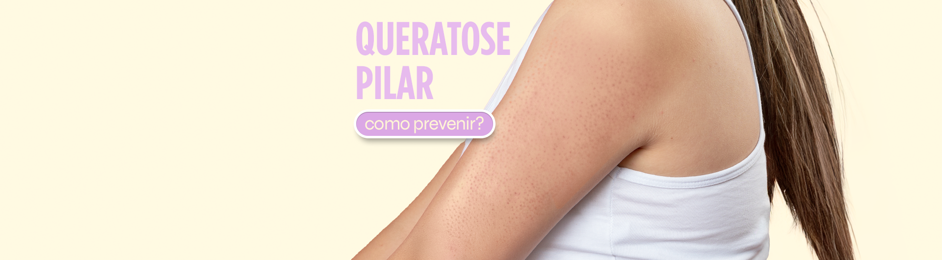 Queratose Pilar: Pode Deixar Manchas na Pele? Como Prevenir?